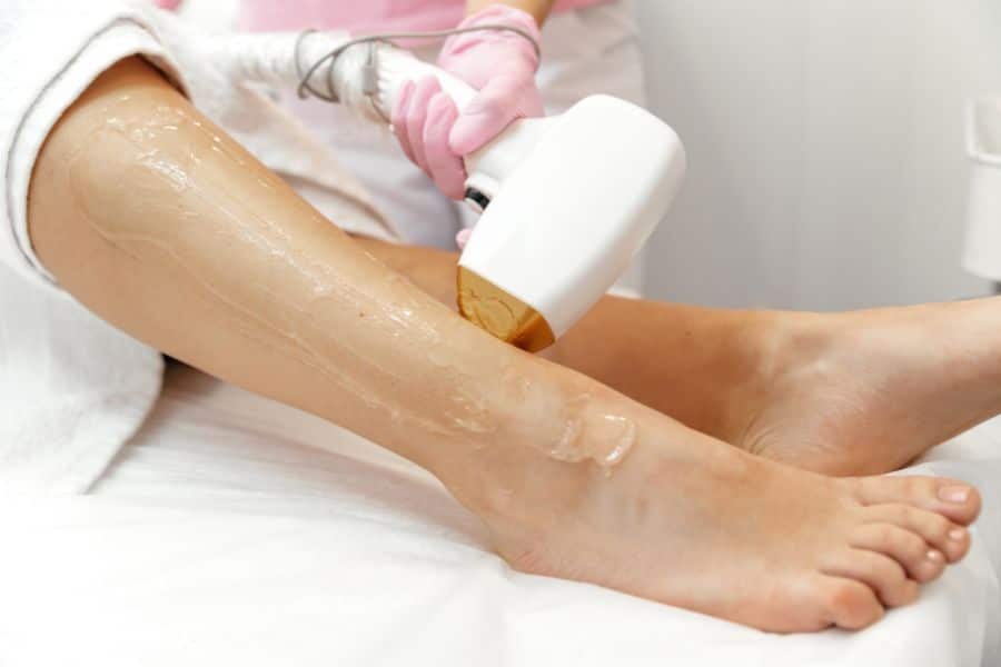 epilation laser jambe